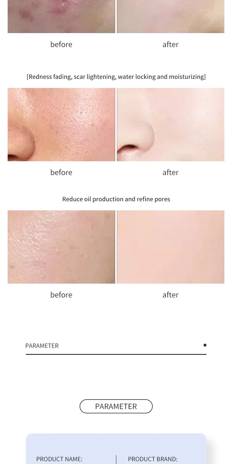 Korean Skincare Facial Lifting Beauty Machine Wrinkle Removal