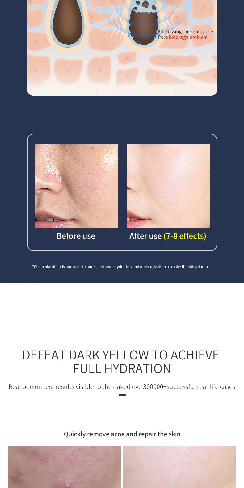 Korean Skincare Facial Lifting Beauty Machine Wrinkle Removal