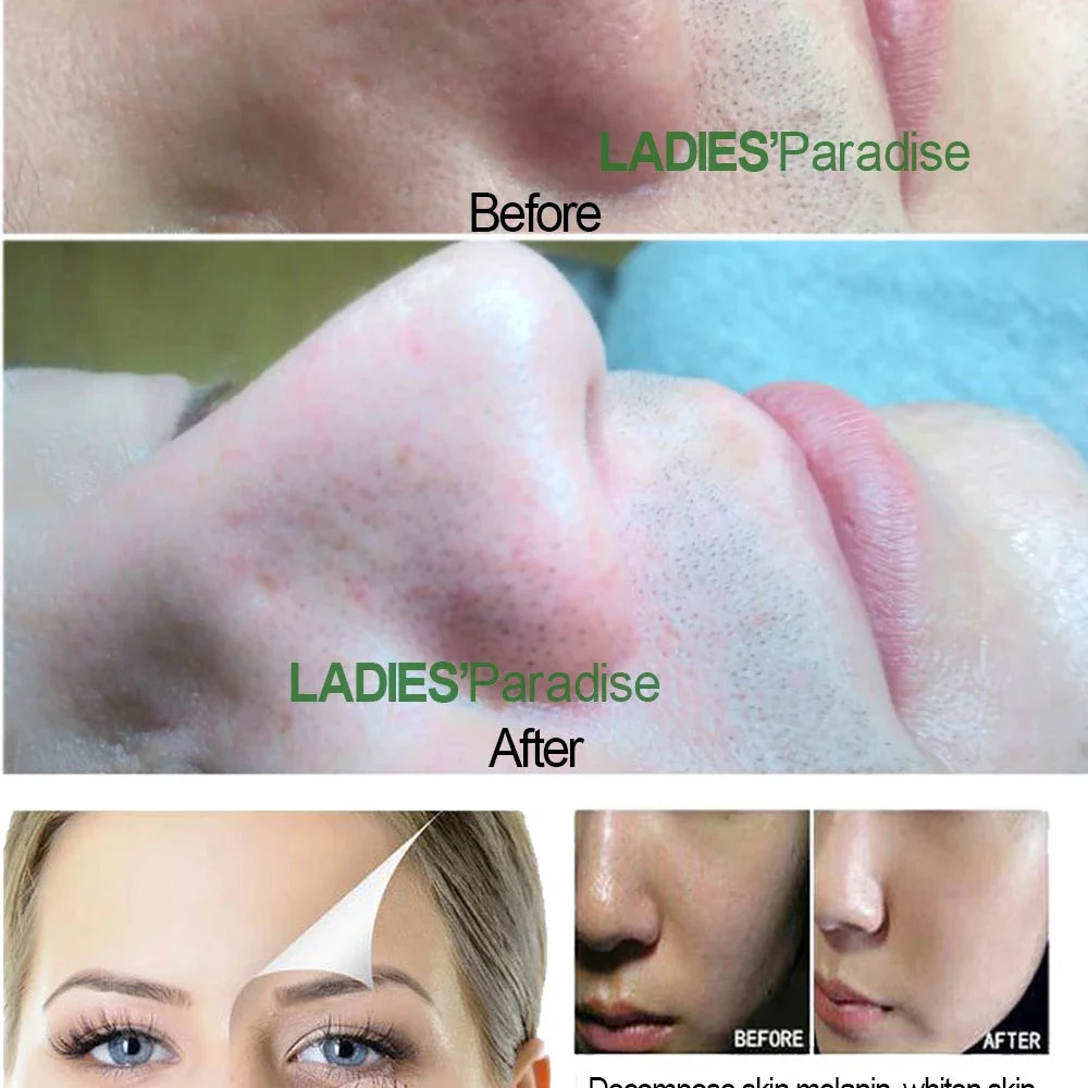 Professional Ultrasonic Facial Skin Scrubber Exfoliatorion Deep
