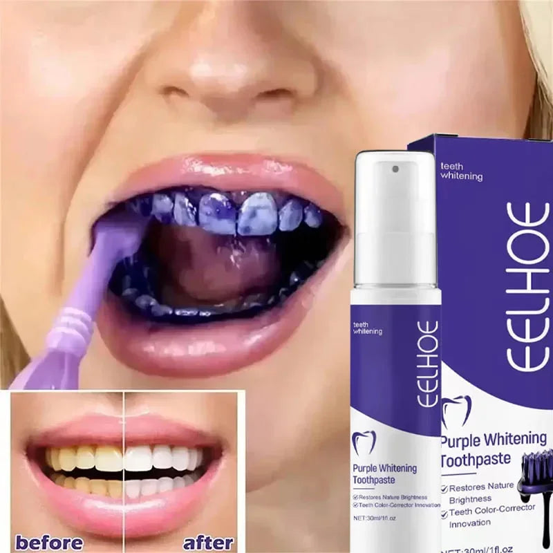 Yg52 Bestselling Whitening Toothpaste Say Goodbye To Yellow