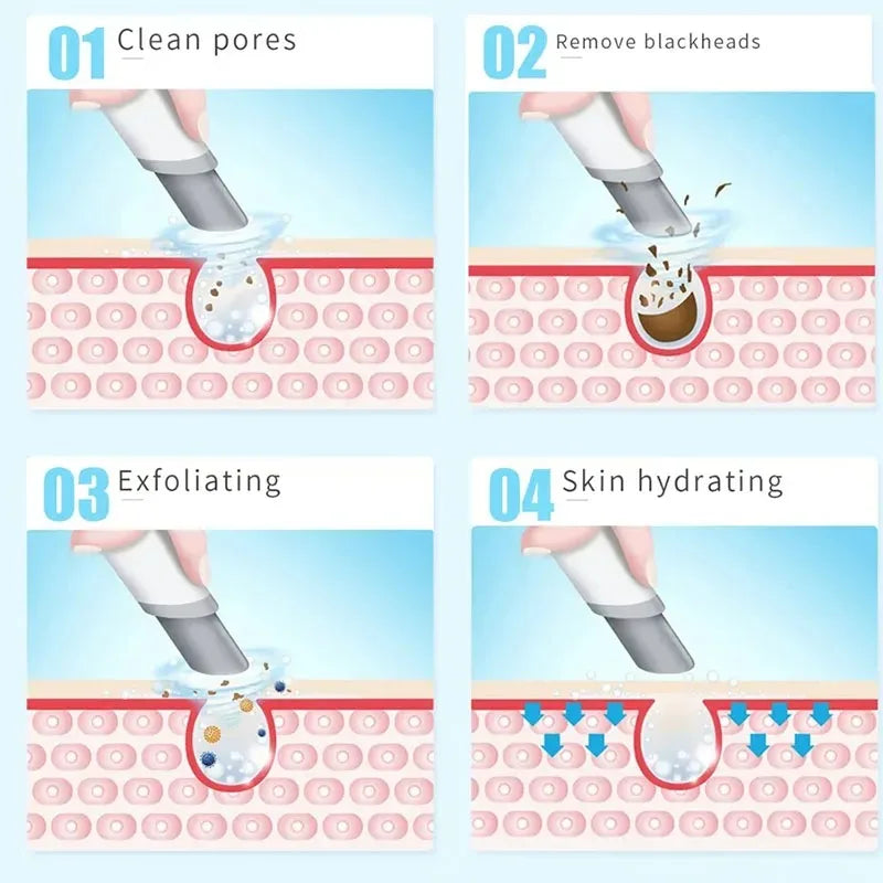 Newest Peeling Beauty Device Hydra Dermabrasion Aqua Facial