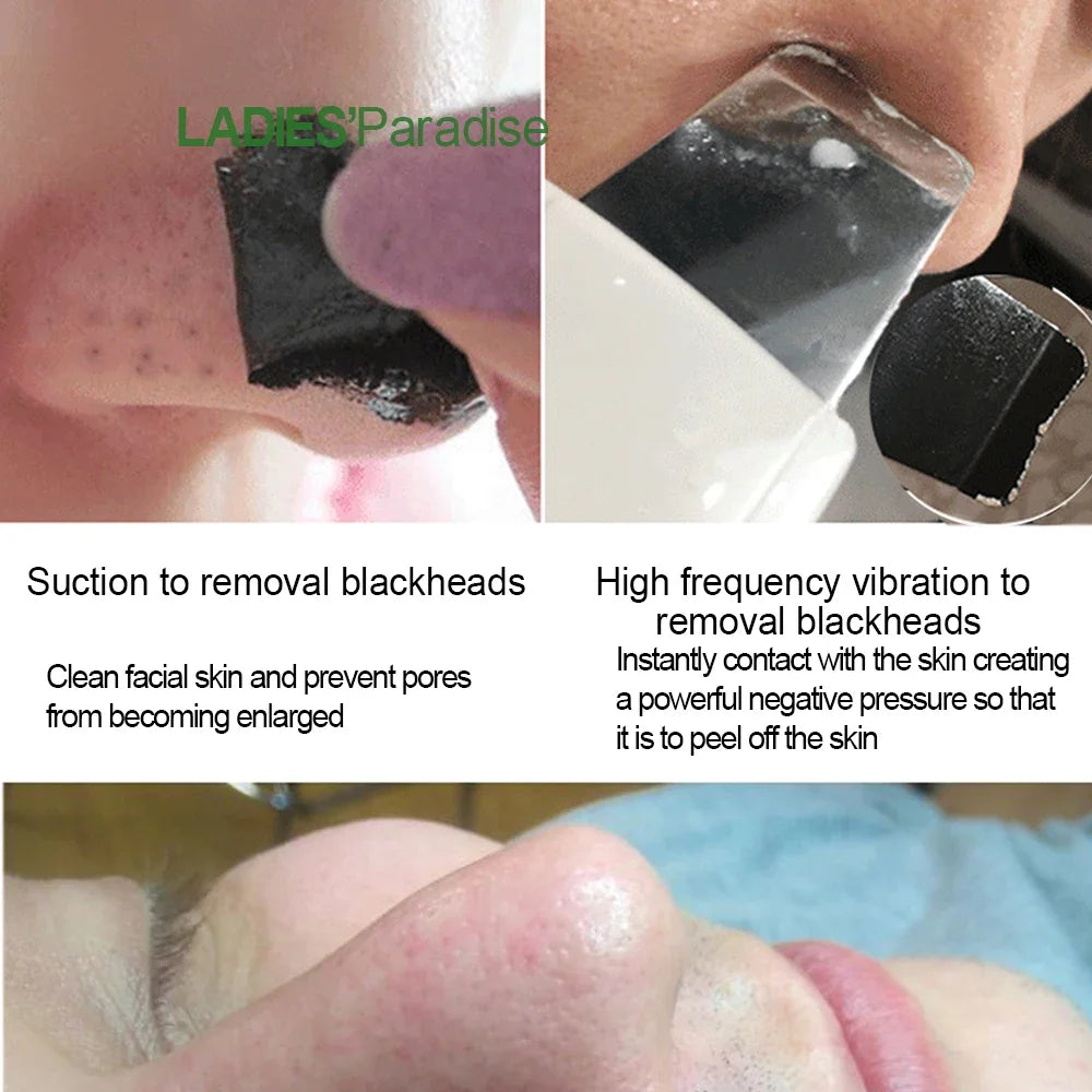 Professional Ultrasonic Facial Skin Scrubber Exfoliatorion Deep