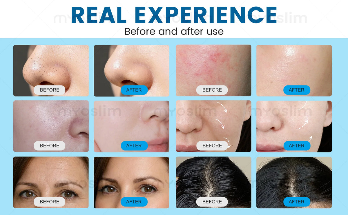 14 In Hydro Beauty Skin Care Master Machine