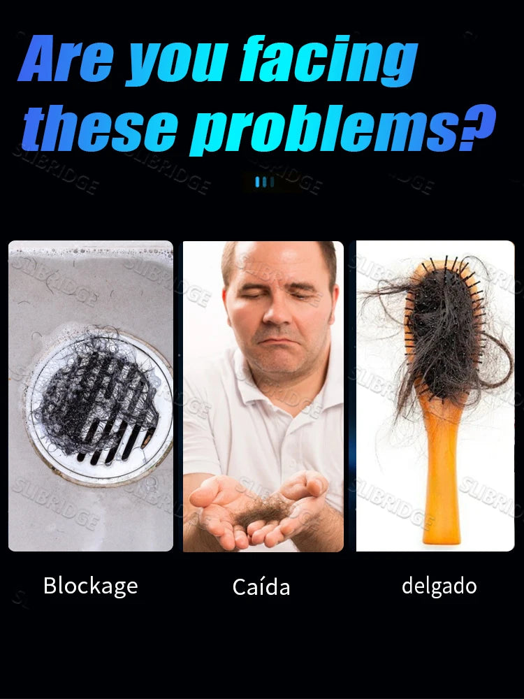 Selling Scalp Massage Roller Brush Hair Care -