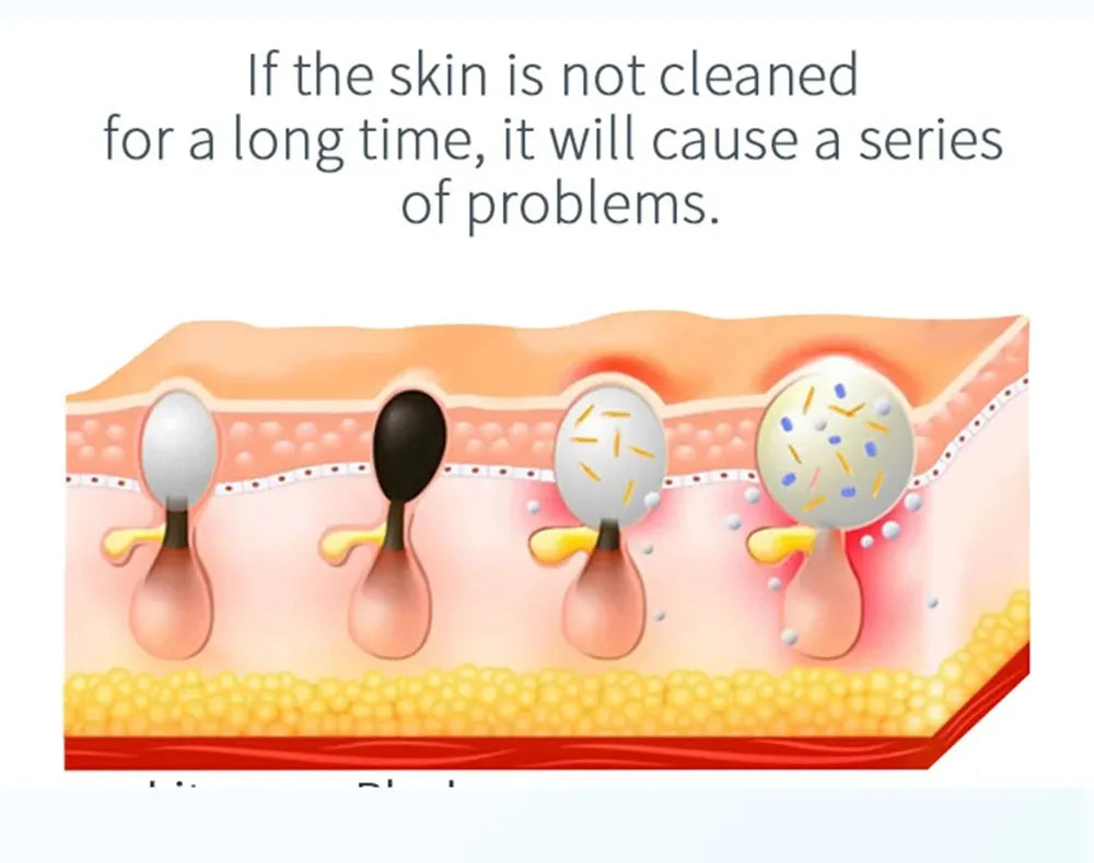 Newest Peeling Beauty Device Hydra Dermabrasion Aqua Facial