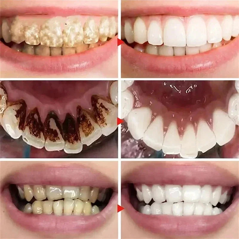 Yg52 Bestselling Whitening Toothpaste Say Goodbye To Yellow