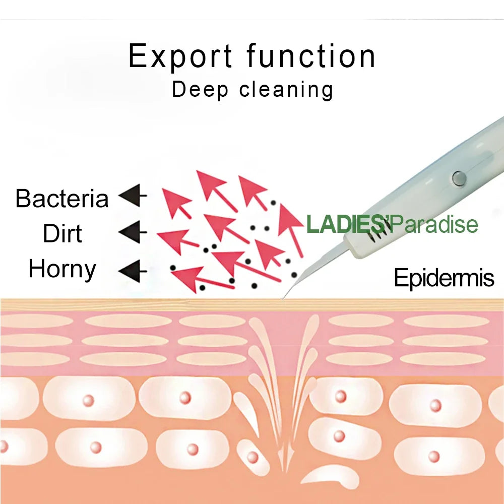 Professional Ultrasonic Facial Skin Scrubber Exfoliatorion Deep