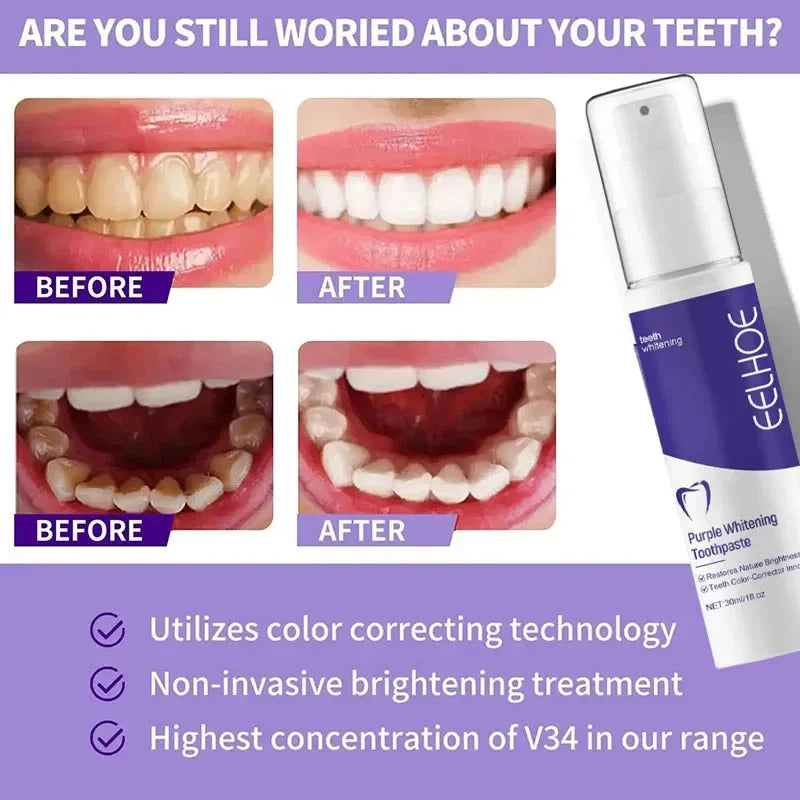 Bestselling Whitening Toothpaste Say Goodbye To Yellow Teeth