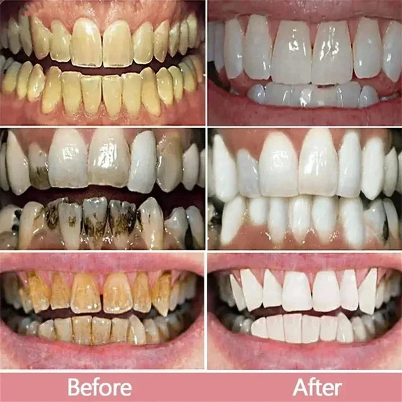 Bestselling Whitening Toothpaste Say Goodbye To Yellow Teeth