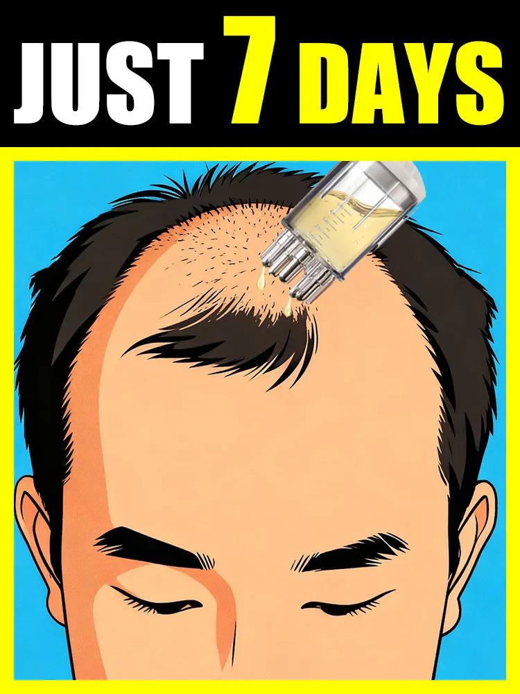 Selling Scalp Massage Roller Brush Hair Care -