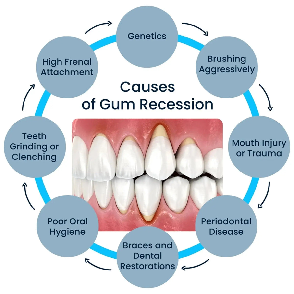 50ml Damaged Gum Repaircare Gel Serum Relieve Sore