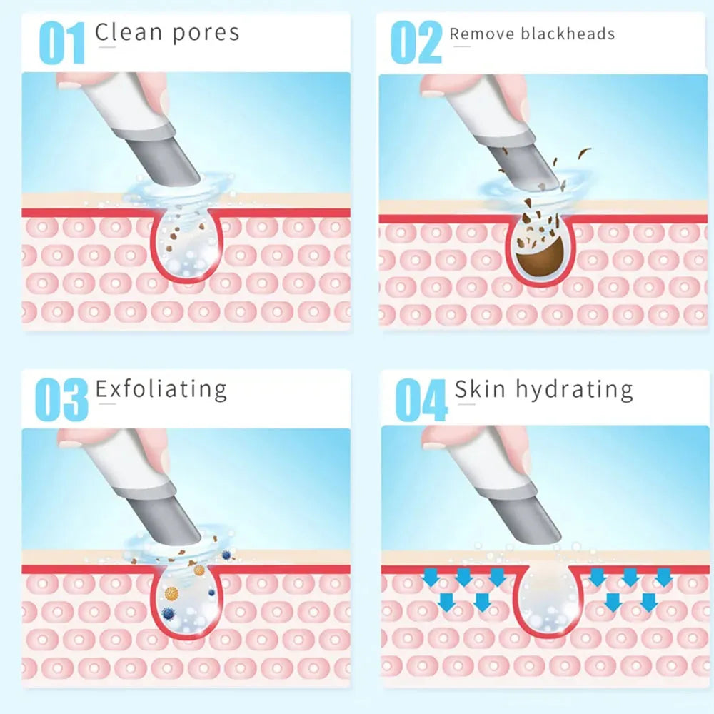 Peeling Beauty Device Small Bubble Oxygen Injection Instrument