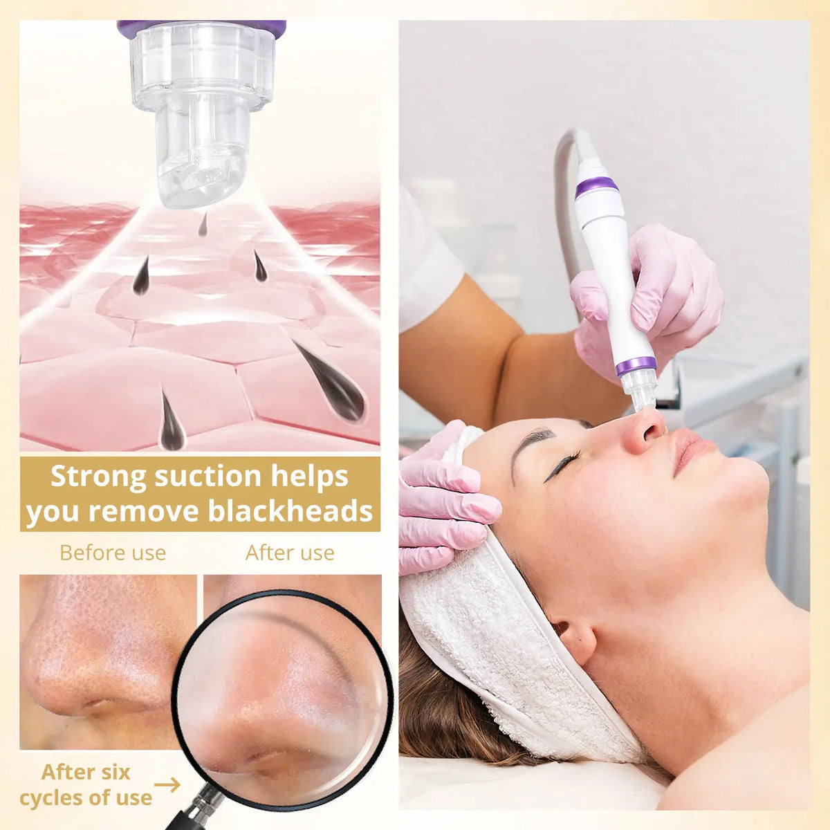 Professional Hydro Water Oxygen Machine Jet Peel Oxy