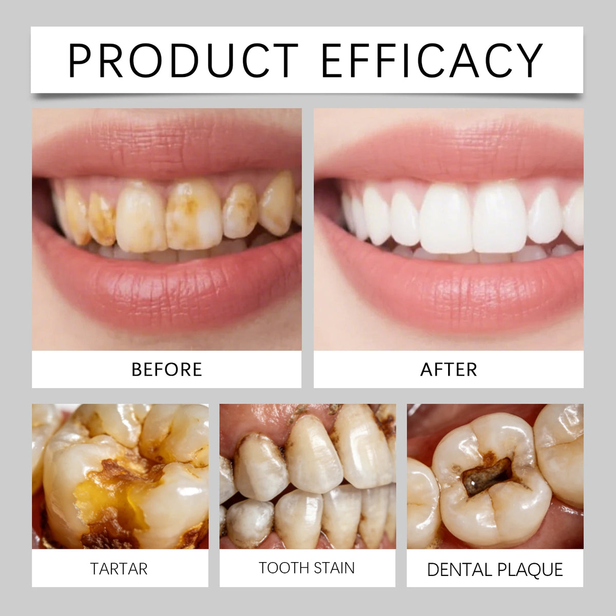 Dental Stain Remover Daily Teeth Cleaning To Reduce