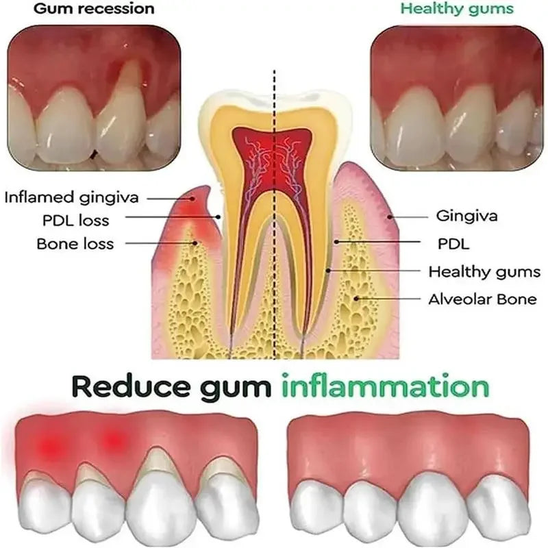 Gum Repair Care Gel Relieve Sore Gum Improve