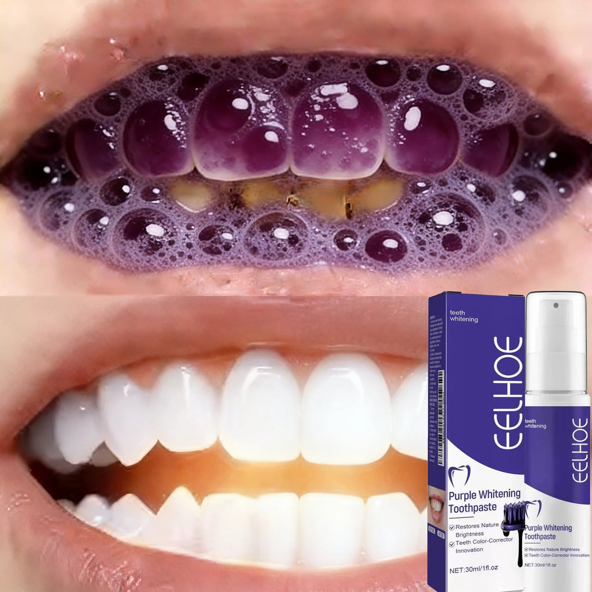 Bestselling Whitening Toothpaste Say Goodbye To Yellow Teeth